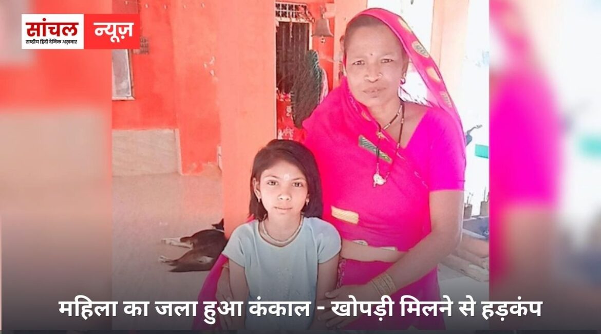 महिला का जला हुआ कंकाल – खोपड़ी मिलने से हड़कंप, मंगलसूत्र से हुई पहचान, पुलिस मामले की जांच में जुटी